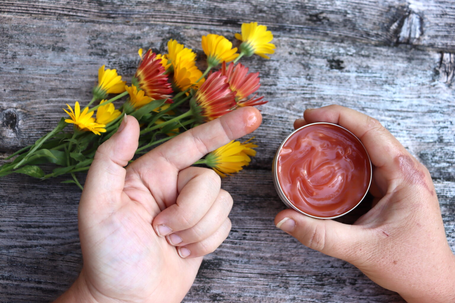 Applying Herbal Burn Salve